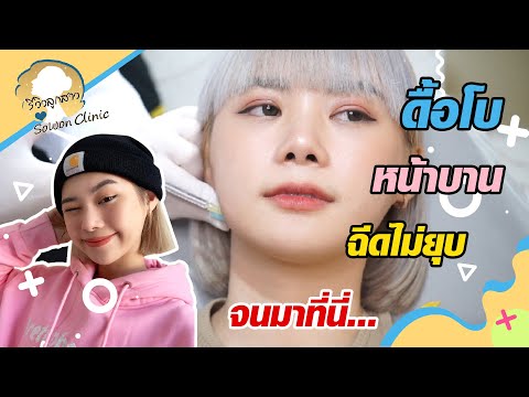 โบท็อก ปีกจมูก