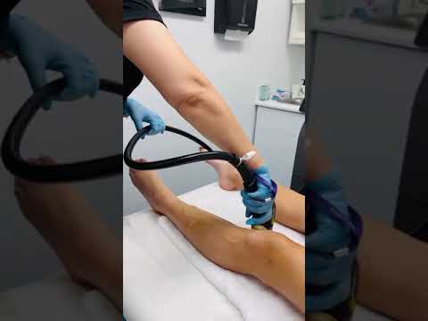 Laser Hair Removal