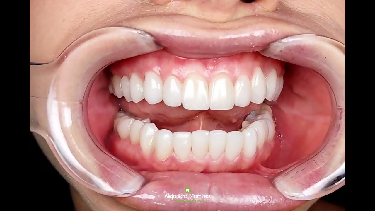 Alejandro Martinez-24