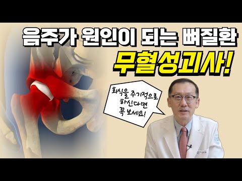 음주가 일으키는 뼈 질환! 무혈성괴사!
