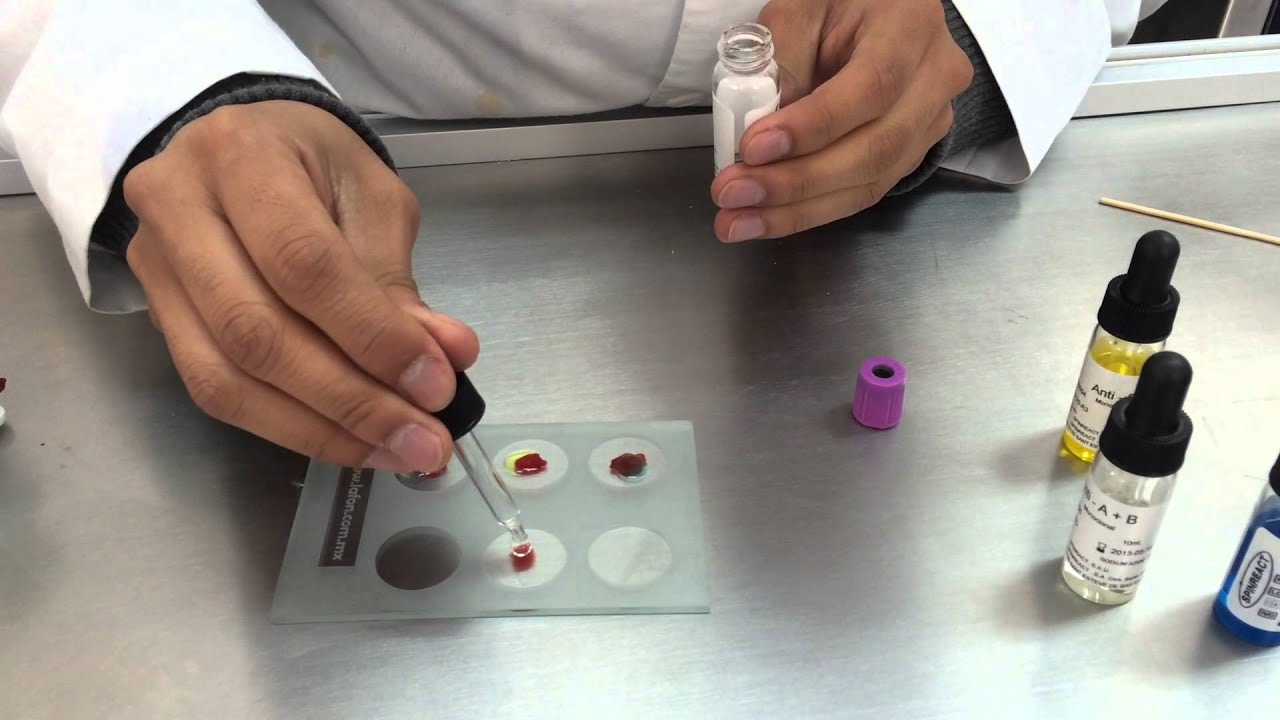 Determinación de grupo sanguineo QFB Universidad Justo Sierra