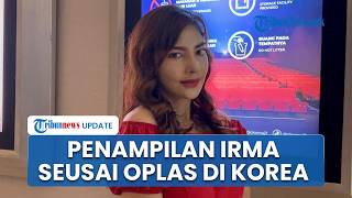 Akan Menikah, Irma Darmawangsa Rela Oplas di Korea Capai 300 Juta untuk Tampil Lebih Percaya Diri