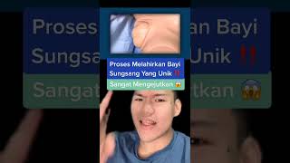 Download lagu Unique breech birth process ‼️ Very shocking 😱 #Shorts #YouTubeShorts mp3