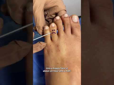 Labor Day Foot Makeover