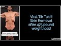 Viral Tik Tok Video by Dr Repta Plastic Surgery