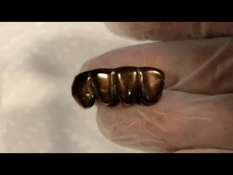 can this extreme tarnish 10k gold grill be cleaned how to stop it from getting tarnished