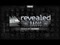 Revealed Radio 033 - Hosted by Bali Bandits 