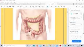 GIT UW- rev all -TOXIC USMLE -Ibrahem Gamal