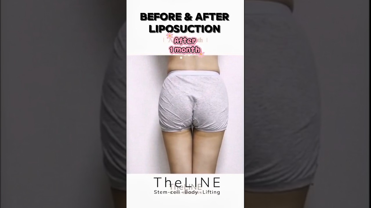 TheLINE shorts video