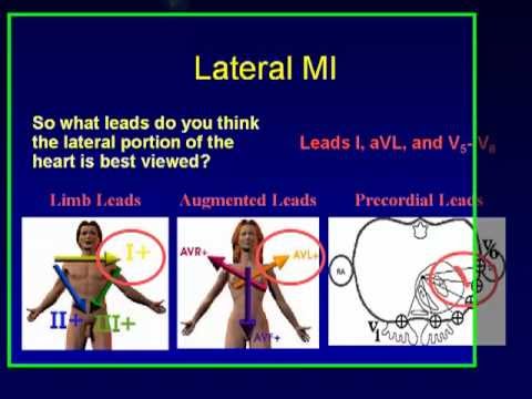 ECG basics new2 by Dr:Esmail Fadel in Aden medical school