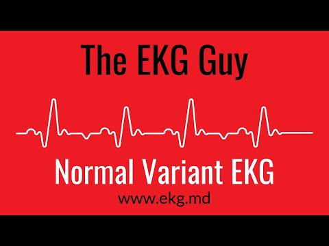 Normal Variant EKG l The EKG Guy - www.ekg.md