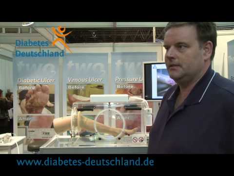 Etwas Zucker im Blut ist für einen Diabetiker normal angesehen Diabetes warum geschwollenes Bein