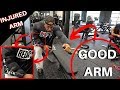 Bicep tear : Why I train one side only