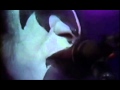 Kiss Calling Dr Love 79 