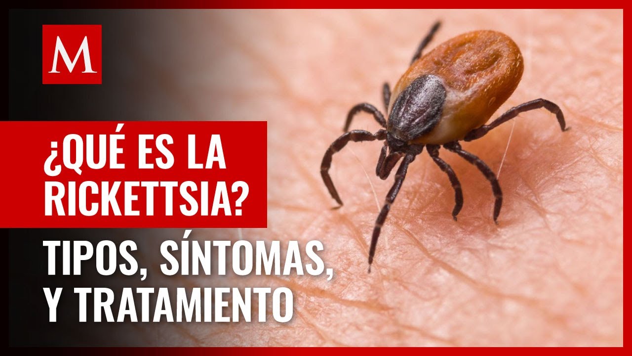 Rickettsia: Qué es y síntomas