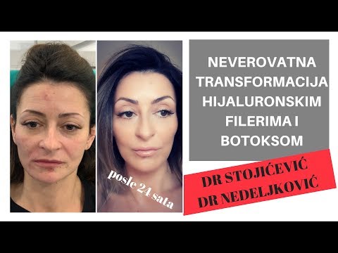 antigrippin i hipertenzija hipertenzija slatko
