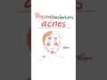 Propionibacterium Acnes Acne Vulgaris Microbiology Science Microbiology Nurse Doctor Mbbs