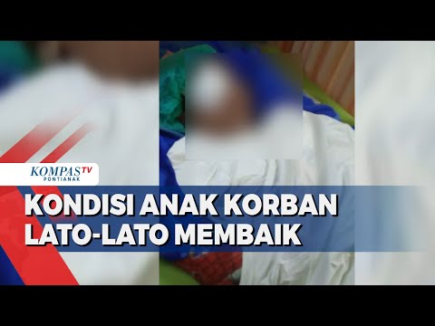 Pascaoperasi, Kondisi Anak Korban Lato-Lato Pecah Membaik & Bisa Masuk Sekolah