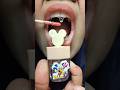 ASMR Magic "Mickey Mouse Gold Glitter Lip Gloss" Becomes Sweet Anomaly Candy!  #short #shorts 1090