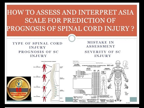 HOW TO ASSESS AND INTERPRET ASIA SCALE FOR PREDICTION OF PROGNOSIS OF SPINAL CORD INJURY ?