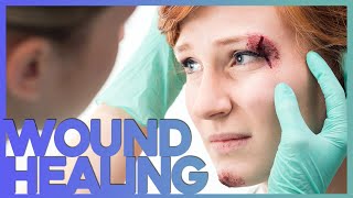 Phases of Wound Healing Explained - How a Cut Becomes a Scar | Corporis