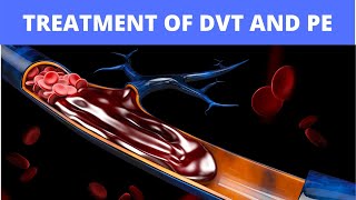 Treatment of DVT and PE