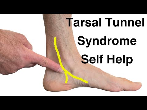 Metatarsalgia and Morton s Neuroma Evaluation and Treatment