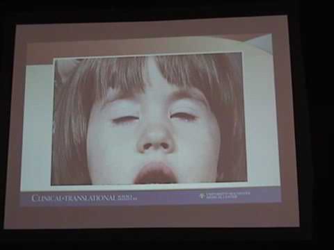 Challenges in Periodic Paralysis Dr Robert Griggs wmv - YouTube