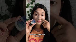 Download lagu Removing My Blackheads with Vaseline⁉️😱🤯 mp3