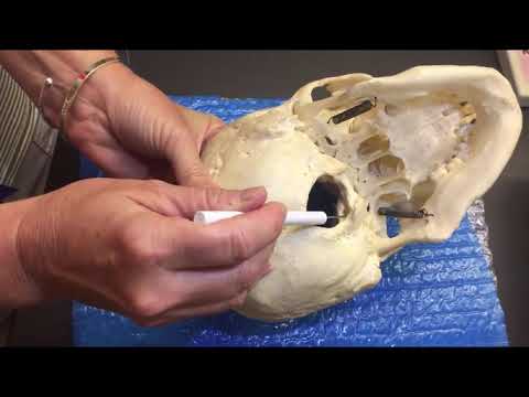 Human Skull - Inferior View