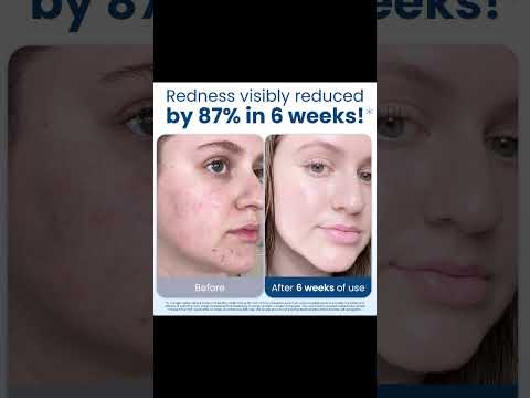 titte Clean Skin Club Clean Towels XL Review 🌿 | Biobased, Ultra Soft & Eczema-Friendly Face Towels!