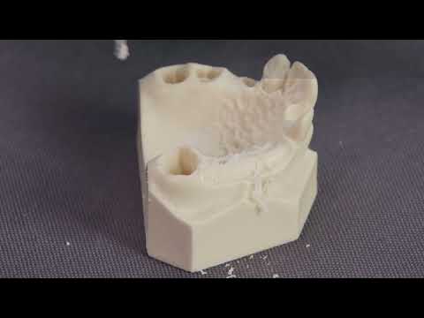 Straumann® iEXCEL™ drilling protocols: Straumann® BLX Implant System – Site 26