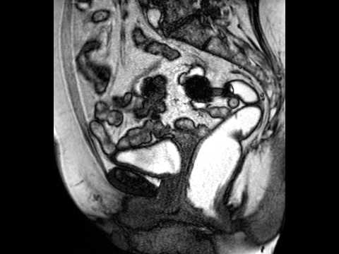 Sehne Knöchel Anatomie Es tut weh, auf dem Rücken schmerzen Klinge liegen