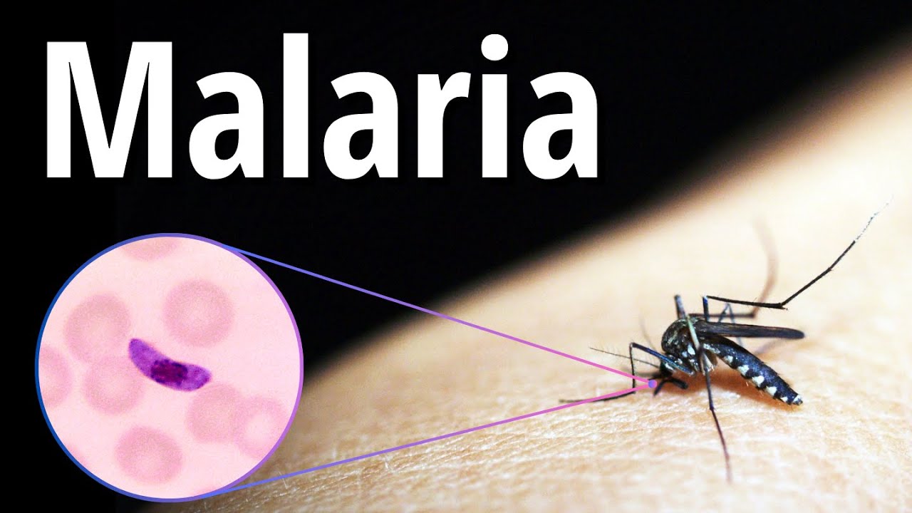 Malaria Explicado Claramente