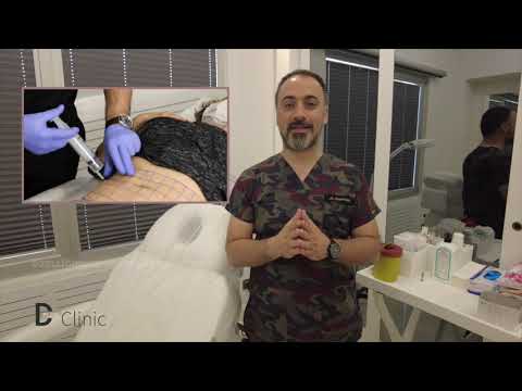 Ozon Terapi Uygulaması