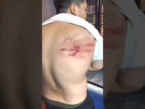 This Kung Fu Master Can Bend Metal With Bare Hands 😱Tongbeiquan (桐背拳)