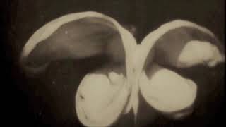 Marilyn Carino - Little Genius -  NO DISGRACE