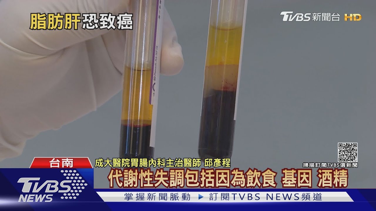 輕忽「脂肪肝」最終變「肝癌」　醫警告：別吃這類食物！