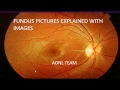 Fundus images explained by an ophthalmologist