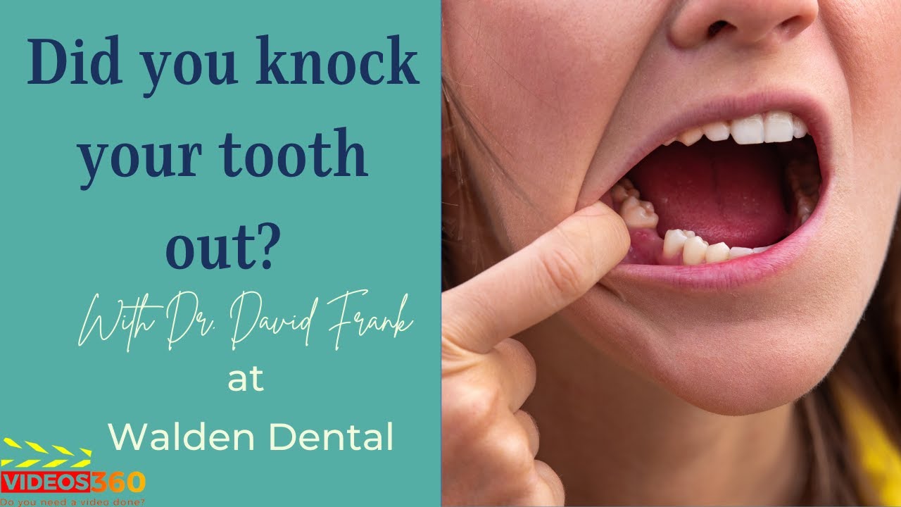 What to do if your tooth gets knocked out?