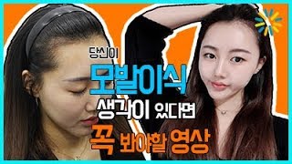 나세르의원 볼필러 전후 및 시술영상