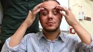 Internal Medicine - Dr Allam _ Dr ElHaw | Thyrotoxicosis_Clinical | AllTebFamily.com