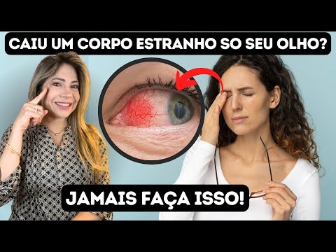 Cisco no Olho: O Que Fazer e Quando Procurar um Oftalmologista?