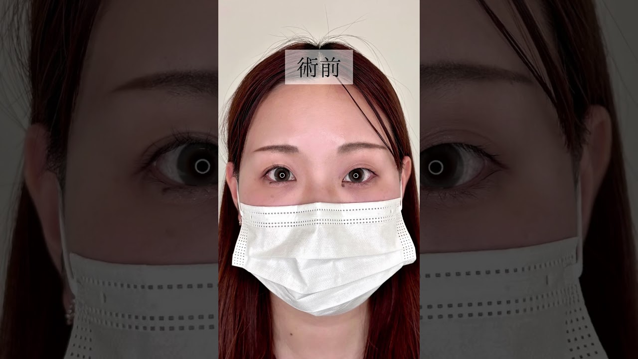 Youtubeのサムネイル