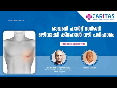 Avoiding open heart surgery through keyhole treatment