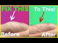 Rib Flare Fix It For Good