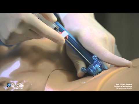 Sonosite AxoTrack® Needle Guidance Technology Part 3: Using the Transducer