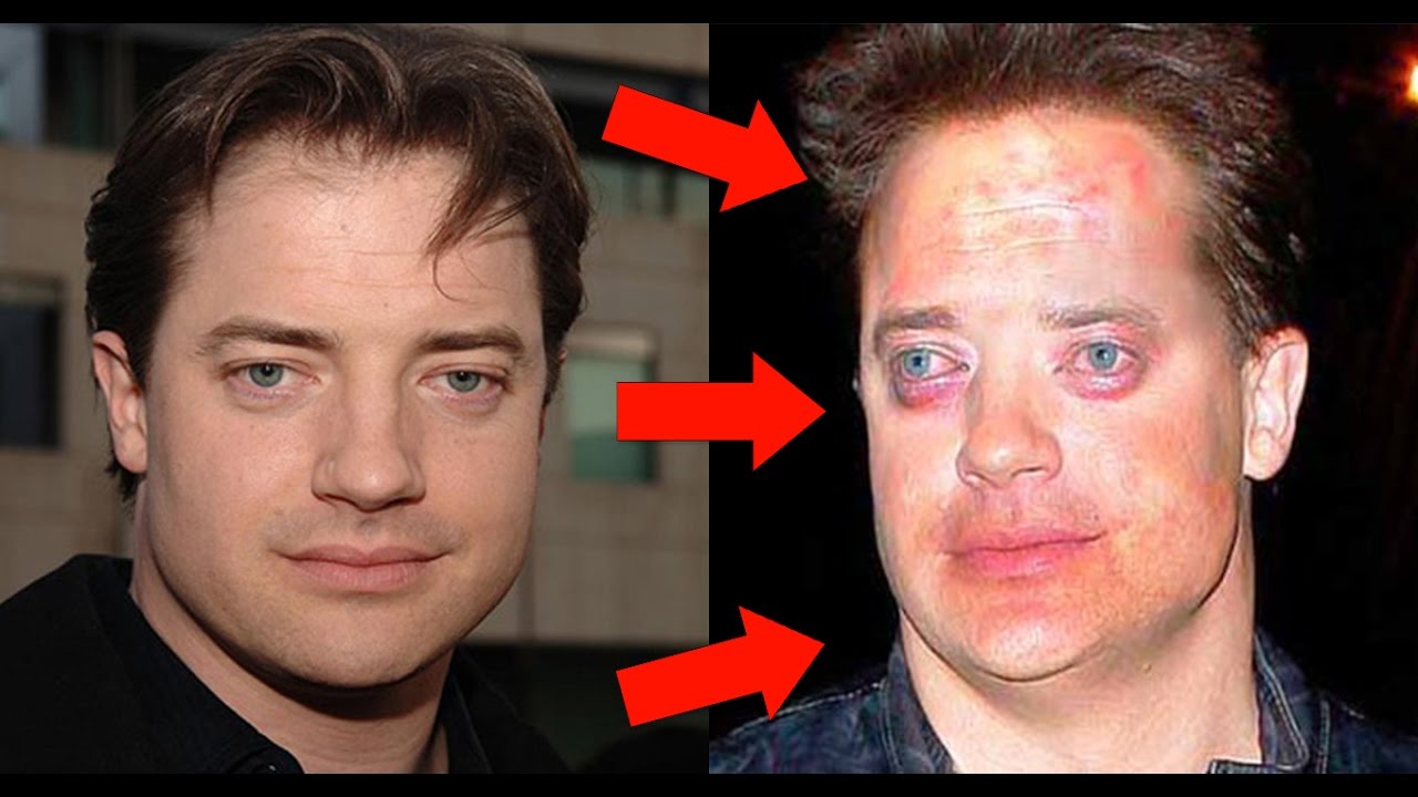 🔴 Do Luxo ao Lixo - Celebridades Milionárias que ficaram Pobres!