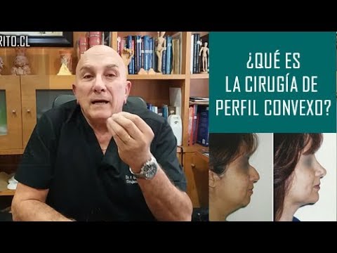 ¿Qué es la Cirugía de Perfil Convexo?