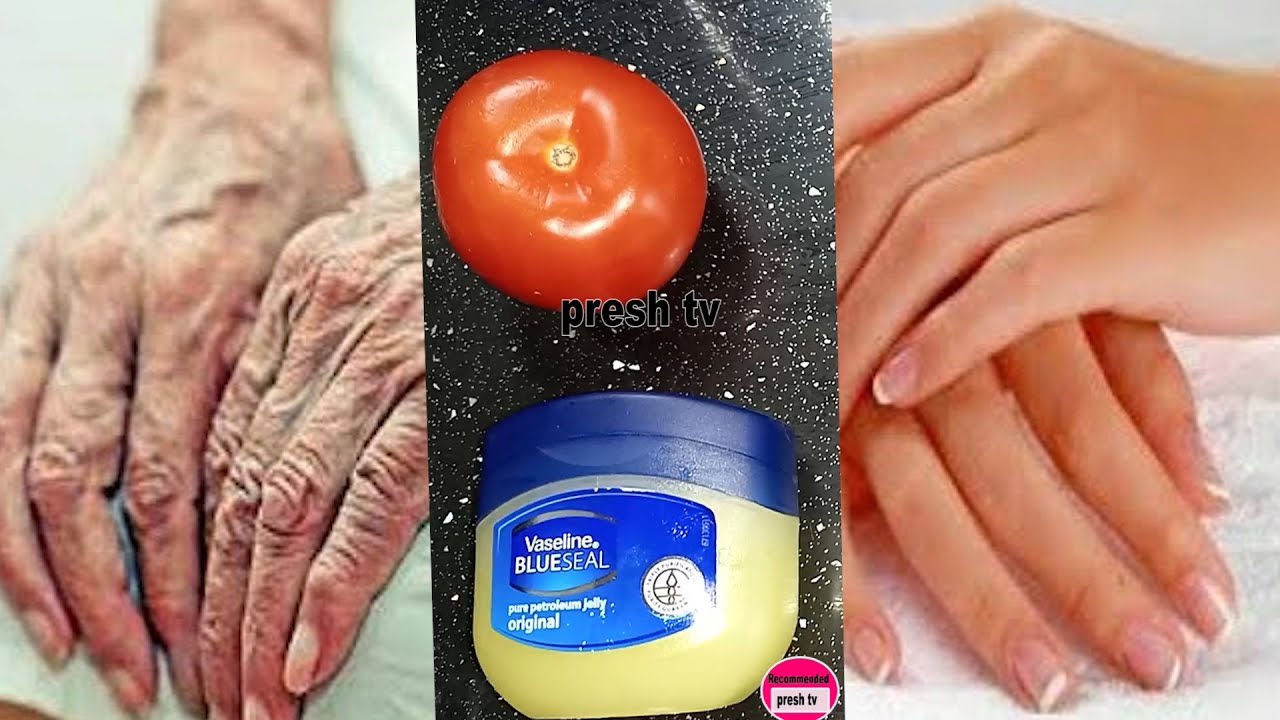 How to make hands soft and wrinkle-free with Vaseline and tomato / How to get rid of rough hands